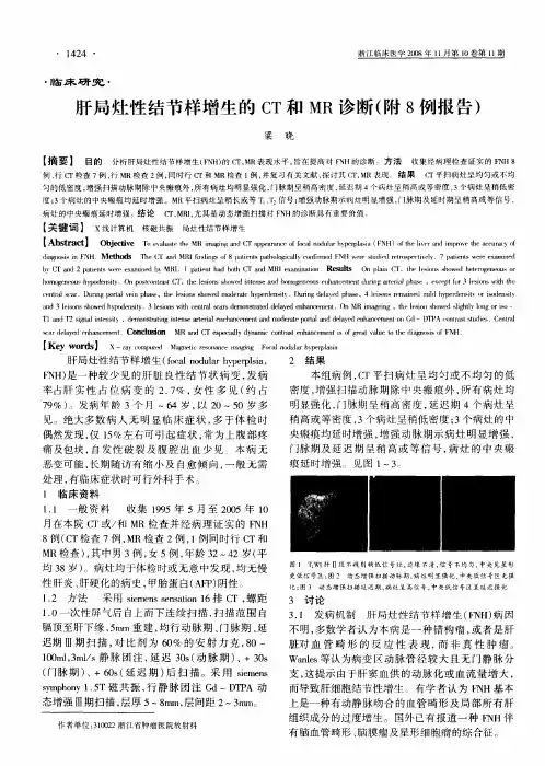 肝局灶性结节样增生的CT和MR诊断(附8例报告)