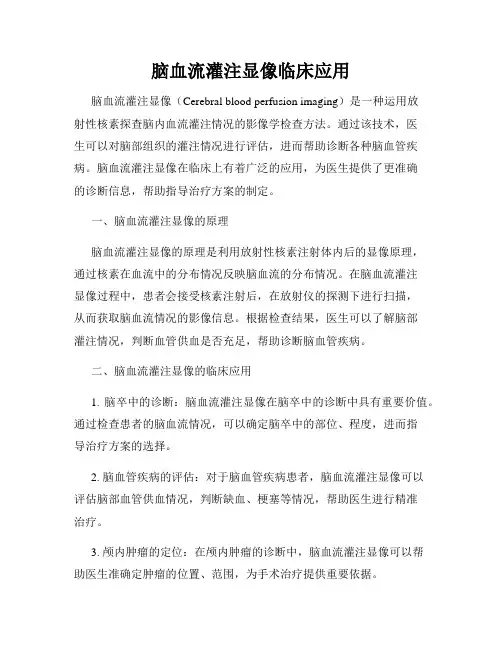 脑血流灌注显像临床应用