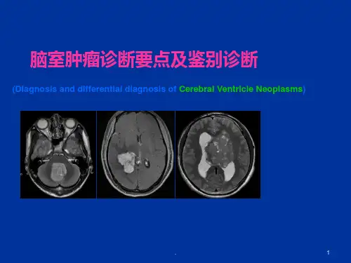 脑室肿瘤诊断要点及鉴别诊断ppt课件