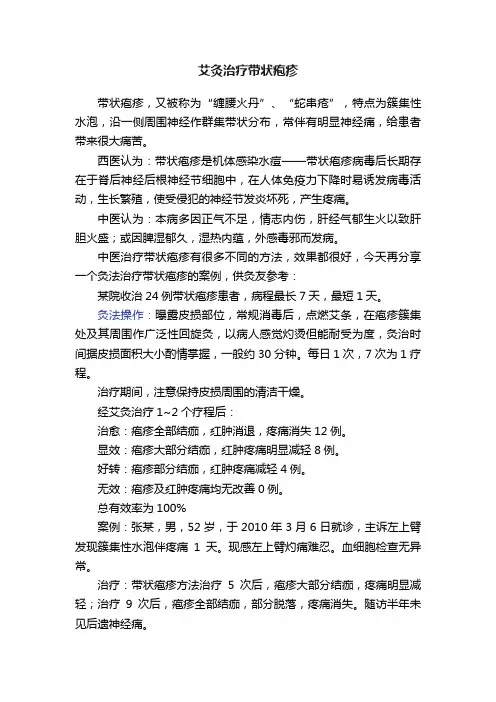 艾灸治疗带状疱疹