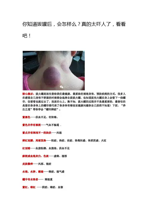 偏方