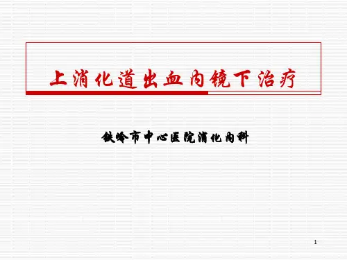 上消化道出血内镜下治疗PPT课件
