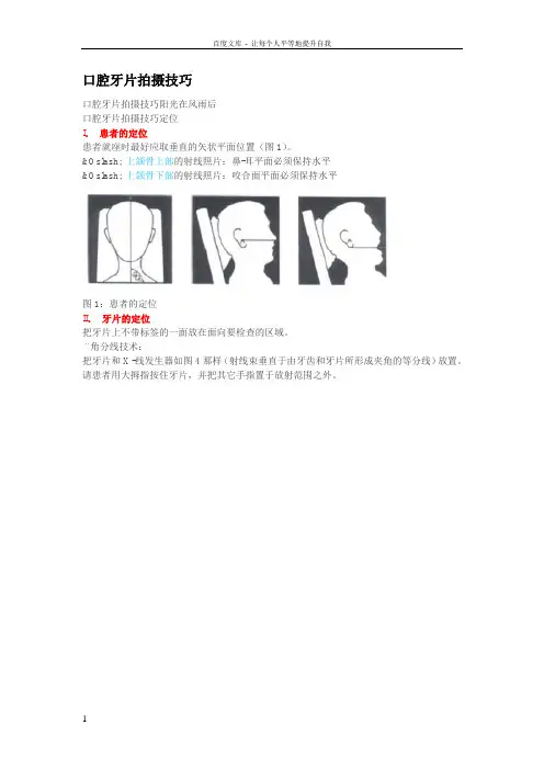 口腔牙片拍摄技巧