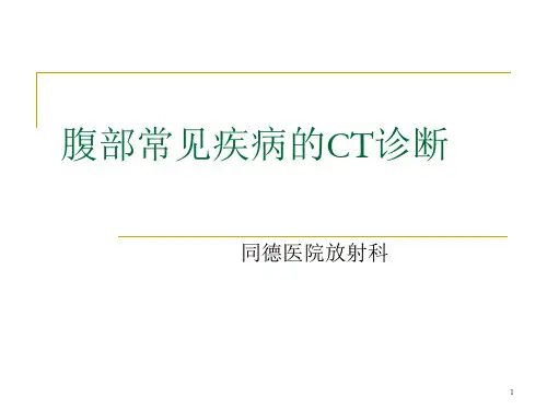 腹部常见疾病的CT诊断PPT课件