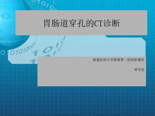 胃肠道穿孔的ct诊断