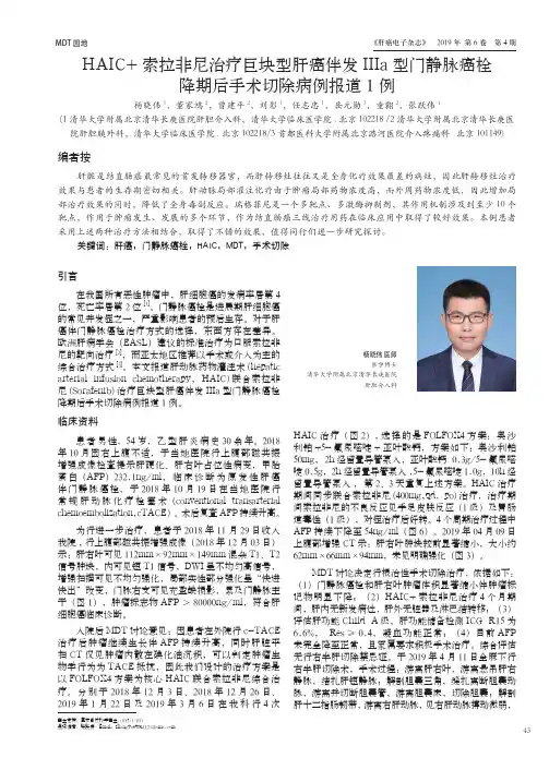 haic+索拉非尼治疗巨块型肝癌伴发Ⅲa型门静脉癌栓降期后手术切除病