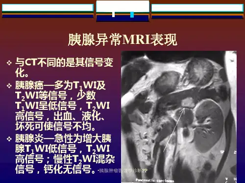 胰腺肿瘤影像学诊断PP课件