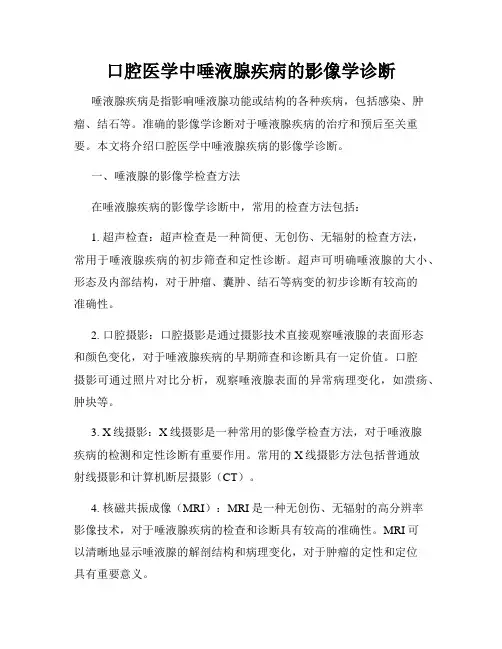 口腔医学中唾液腺疾病的影像学诊断