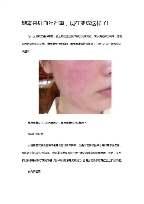 她本来红血丝严重,现在变成这样了!