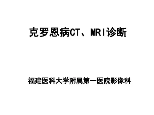 克罗恩病CT MRI诊断 