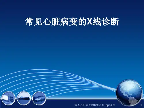 常见心脏病变的X线诊断 ppt课件