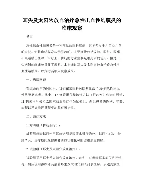 耳尖及太阳穴放血治疗急性出血性结膜炎的临床观察