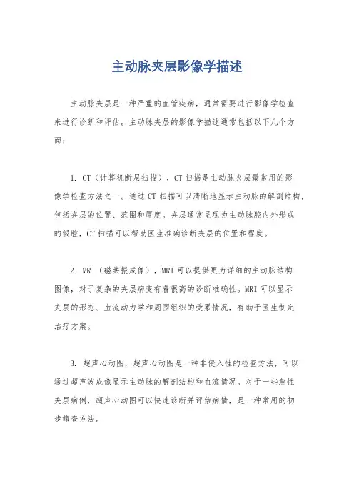 主动脉夹层影像学描述