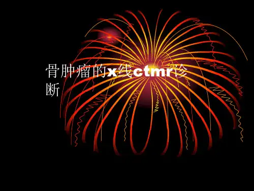常见骨肿瘤的x线ctMr诊断