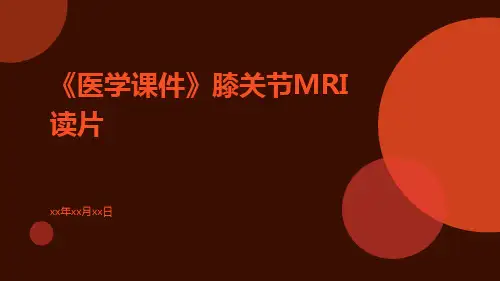 (医学课件)膝关节MRI读片