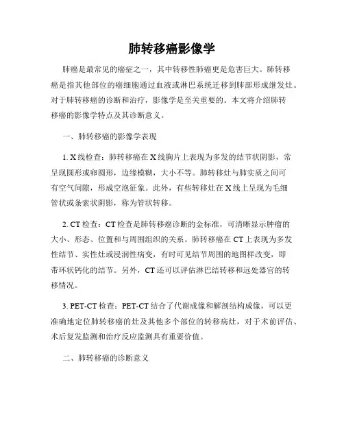 肺转移癌影像学