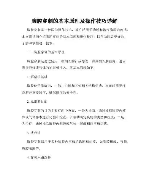 胸腔穿刺的基本原理及操作技巧详解