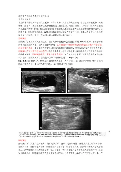 超声诊断骨骼肌肉系统软组织肿物
