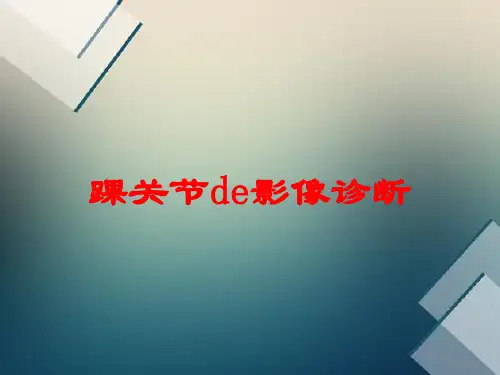 踝关节的影像诊断培训课件