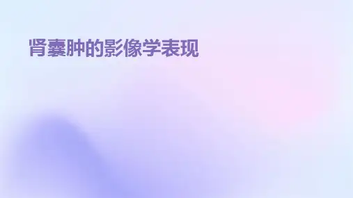 肾囊肿的影像学表现