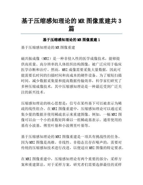 基于压缩感知理论的MR图像重建共3篇