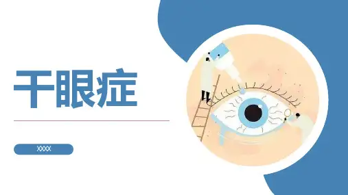 干眼症介绍PPT模板