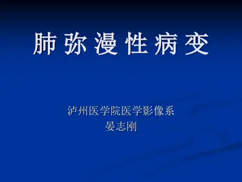 肺弥漫性病变--晏志刚