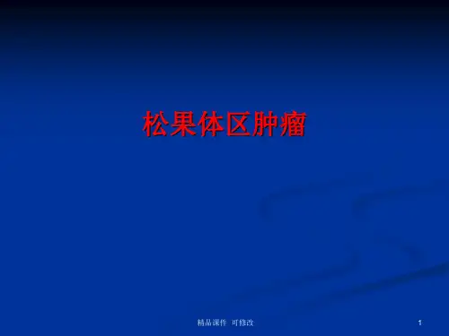 松果体区肿瘤医学课件