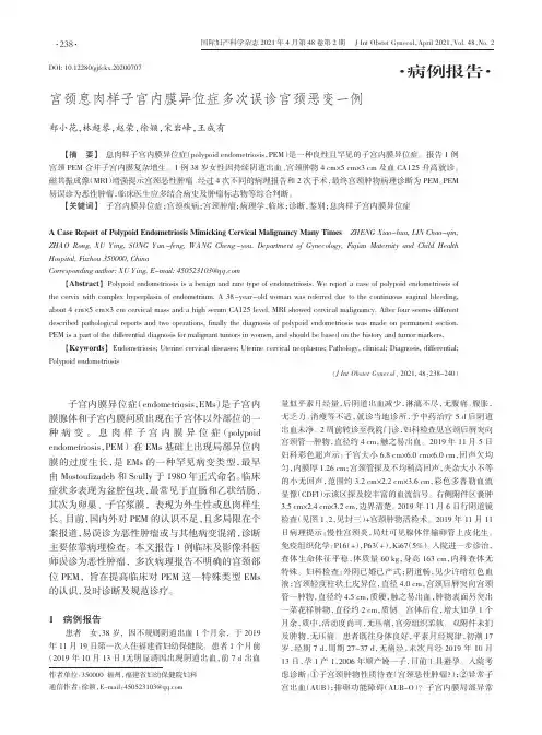 宫颈息肉样子宫内膜异位症多次误诊宫颈恶变一例
