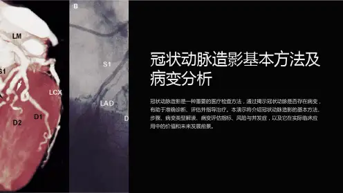 冠状动脉造影基本方法及病变分析