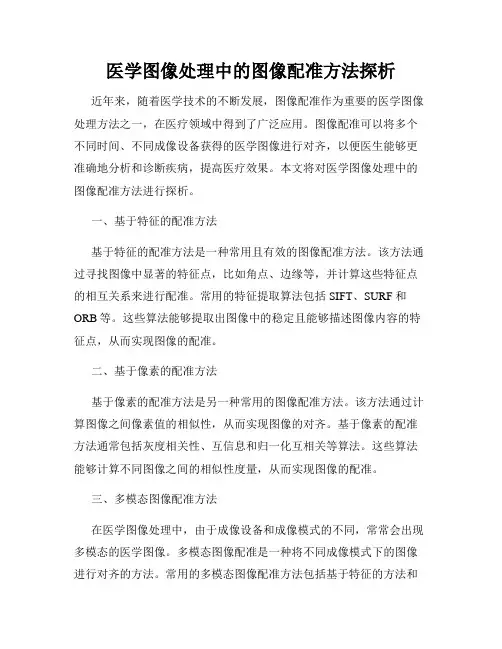 医学图像处理中的图像配准方法探析