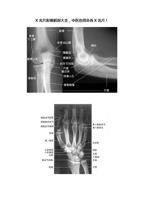 X光片影像解剖大全，中医也得会看X光片！
