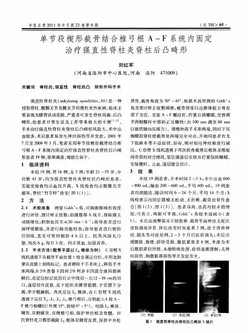 单节段楔形截骨结合椎弓根A-F系统内固定治疗强直性脊柱炎脊柱后凸畸形