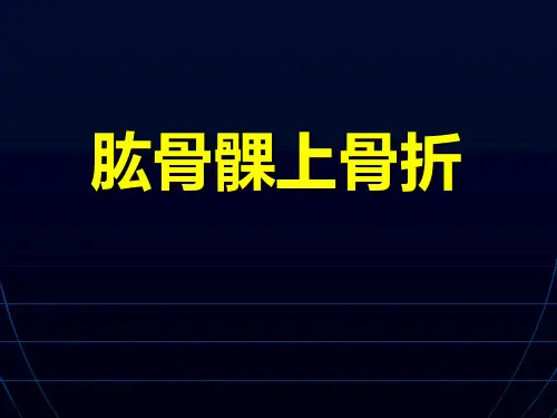 肱骨髁上骨折