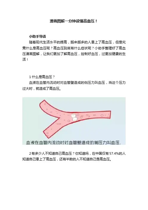 漫画图解一分钟读懂高血压！