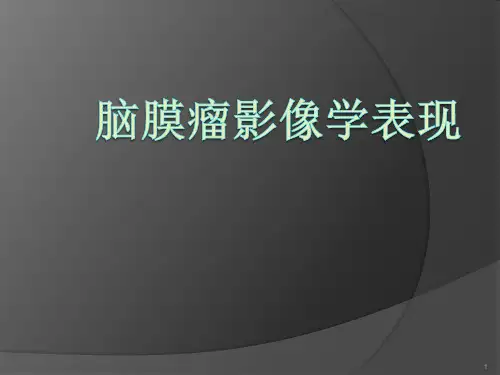 脑膜瘤影像学表现ppt课件