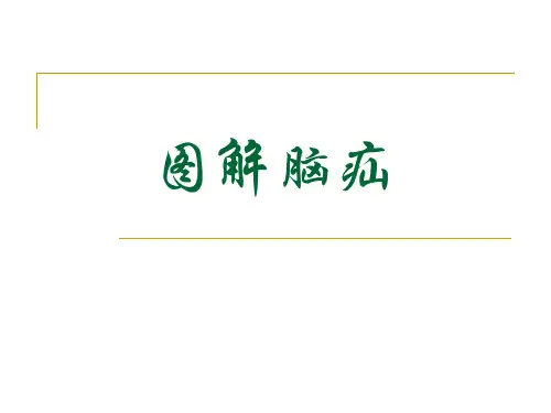 图解脑疝 -优秀医学PPT课件