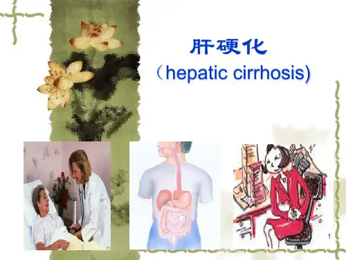 肝硬化讲课PPT课件