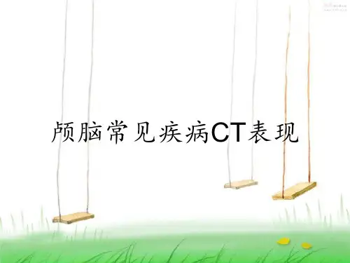 颅脑常见疾病CT表现