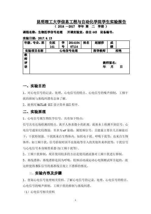 心电信号