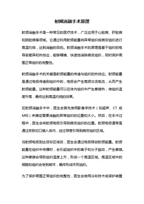 射频消融手术原理