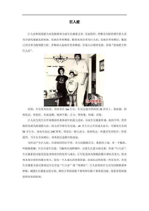 激素调节拓展资料-巨人症