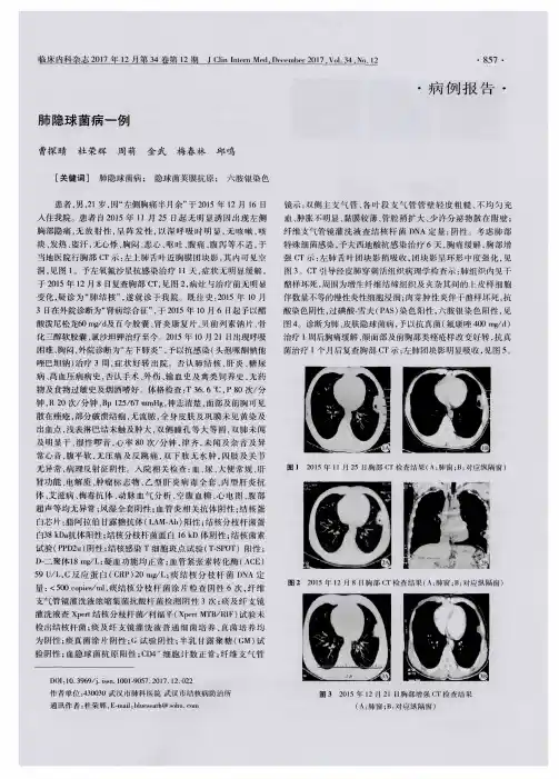 肺隐球菌病一例