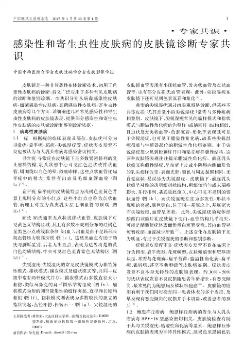 感染性和寄生虫性皮肤病的皮肤镜诊断专家共识