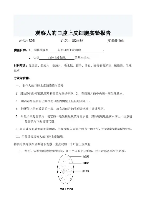 观察人口腔上皮细胞实验报告.doc