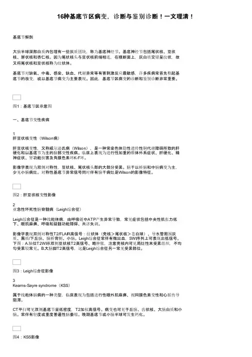 16种基底节区病变，诊断与鉴别诊断！一文理清！