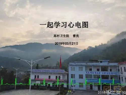 一起学习心电图