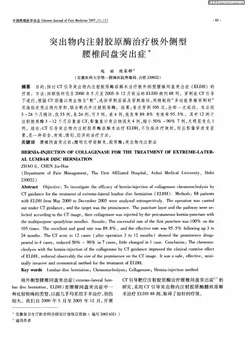 突出物内注射胶原酶治疗极外侧型腰椎间盘突出症