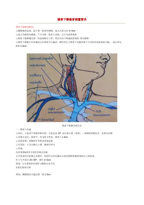 锁骨下静脉穿刺置管术