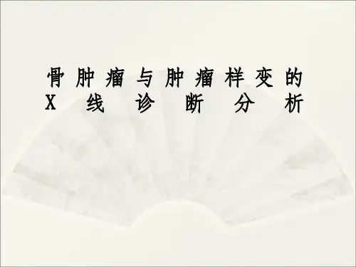 骨肿瘤鉴别诊断攻略